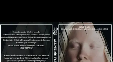 Öğrencilerimizden Albinizmli Bireyler Üzerine Proje